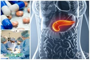 ������� ��� ��� �� ���������