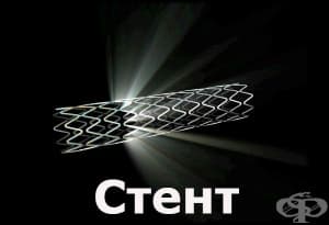 Стент