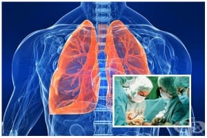 �������������� �� ��� ����