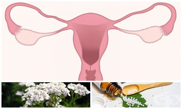 Киста на яйчника - лечение с билки и естествени средства - изображение