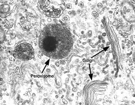  (Peroxisomes) - 