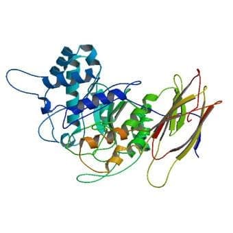  (laronidase) | ATC A16AB05 - 