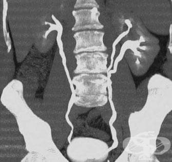 ,       (Watersoluble, nephrotropic, high osmolar X-ray contrast media) | ATC V08AA - 