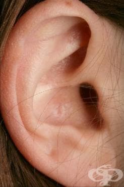 Ушите като причина за световъртеж - изображение