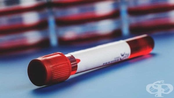 Кръвните групи са свързани с определени заболявания - изображение