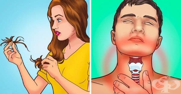 10 признака показват, че тялото ви сигнализира за йоден дефицит - изображение