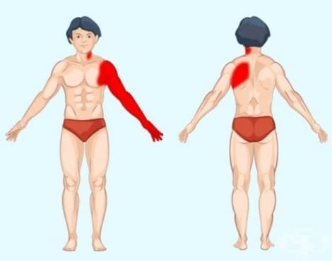 Как да разберете какво наистина ви причинява болка - изображение