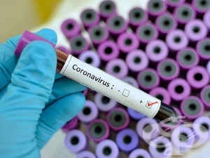 Какви са вашите очаквания за епидемията от коронавирус? - изображение