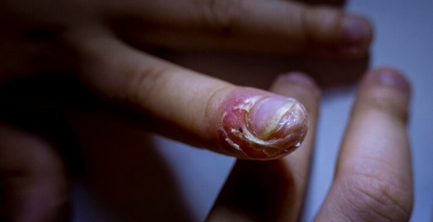 Паронихия - изображение