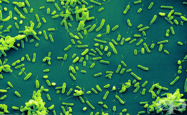 Хемофилни бактерии (Haemophilus) - изображение
