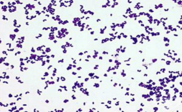 Други коринебактерии - изображение