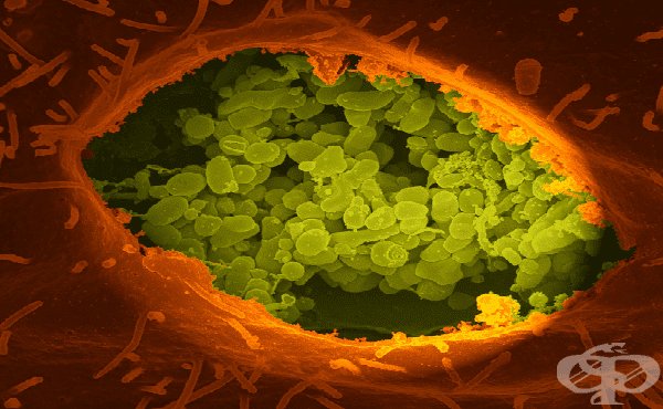 Причинител на Ку-треската (Coxiella burnetii) - изображение