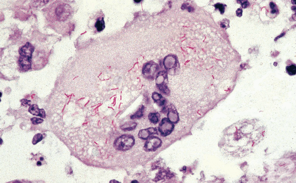 Причинител на марсилската треска (Rickettsia conorii) - изображение