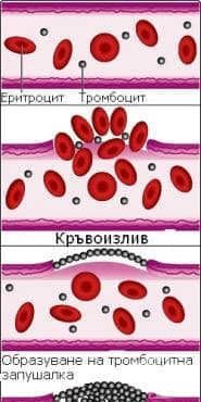 Тромбоцитопения, неуточнена МКБ D69.6 - изображение