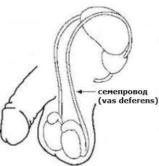   vas deferens  Q55.3 - 