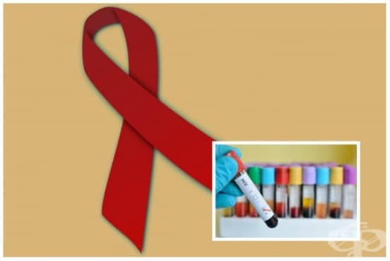 ,   HIV,     ,    B22.7 - 