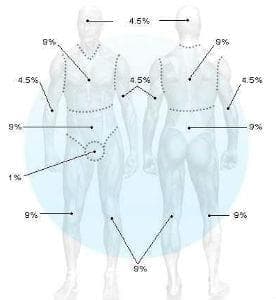   - 20-29%      T32.2 - 