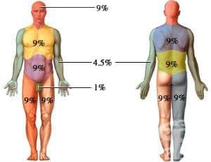   - 40-49%      T32.4 - 