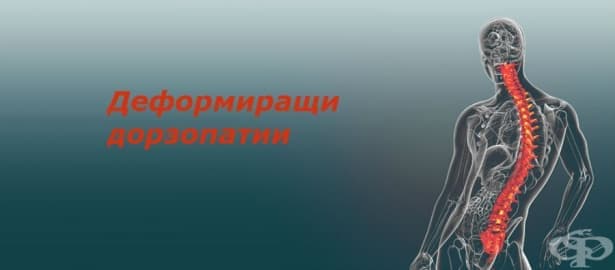 Деформиращи дорзопатии МКБ M40-M43 - изображение