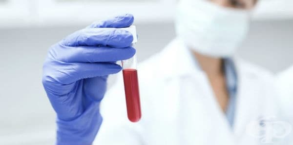 Доброкачествено новообразувание на други и неуточнени ендокринни жлези МКБ D35 - изображение