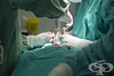 Други увреждания на храносмилателните органи след медицински процедури, некласифицирани другаде МКБ K91.8 - изображение