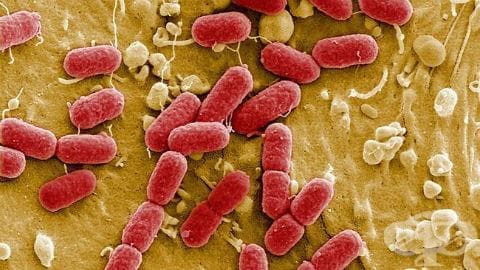 Ентерохеморагична инфекция, предизвикана от Escherichia coli МКБ A04.3 - изображение