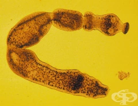       ,   Echinococcus multilocularis  B67.6 - 
