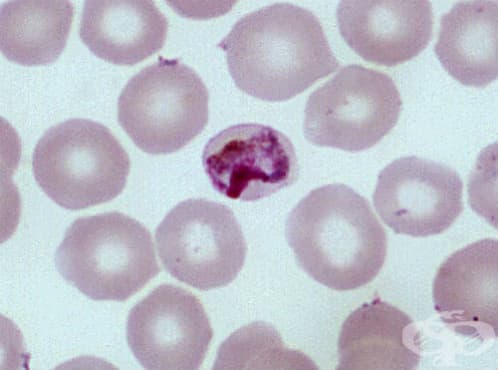 ,   Plasmodium malariae    B52.9 - 
