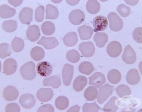 ,   Plasmodium malaria    B52.0 - 