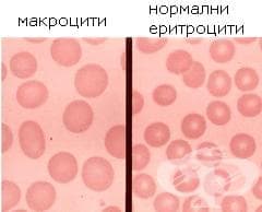 Витамин B12-недоимъчна анемия, причинена от избирателно нарушаване на усвояването на витамин B12 при хранене МКБ D51.1 - изображение