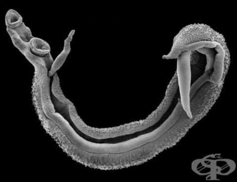 ,   Schistosoma haematobium [ ]  B65.0 - 