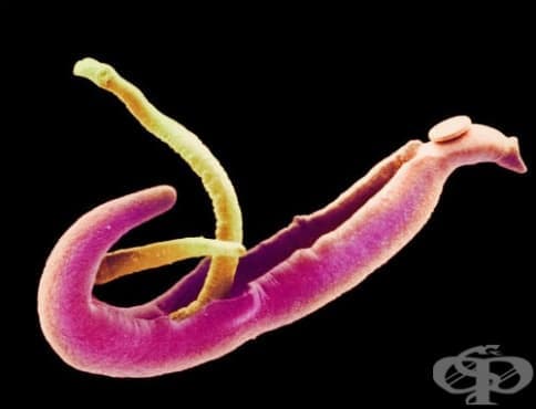 ,   Schistosoma japonicum [ ]  B65.2 - 