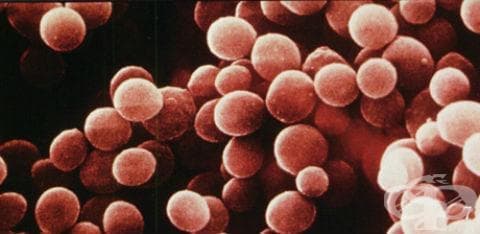 Септицемия, предизвикана от Staphyloccocus aureus МКБ A41.0 - изображение