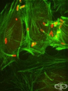 Шигелоза, предизвикана от Shigella flexneri МКБ A03.1 - изображение