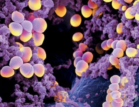 Staphylococcus aureus като причина за болести, класифицирани другаде МКБ B95.6 - изображение