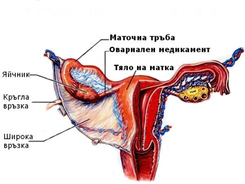 Злокачествено новообразувание  на други и неуточнени части  на женските полови органи МКБ C57 - изображение