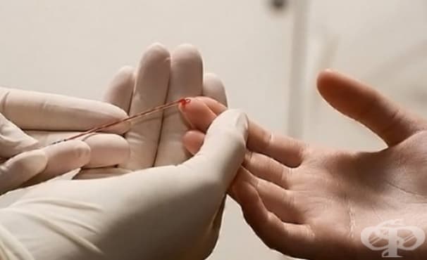 Стартира журналистически конкурс "Свят без хепатит С", посветен на борбата с хепатит С - изображение