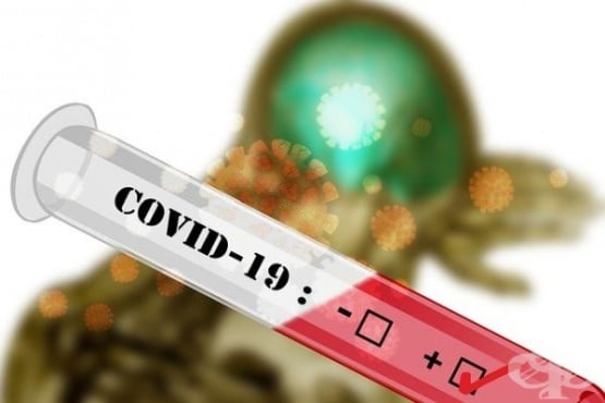 13  2020-: 3414    COVID-19  38 %   8885 PCR  - 