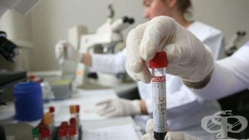 Безплатни прегледи за нарушения на паметта стартират в Русе - изображение