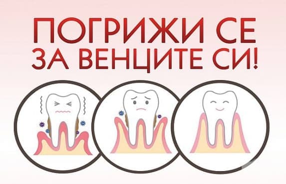 МУ – Варна провеждат кампания за безплатни прегледи Погрижи се за венците си - изображение