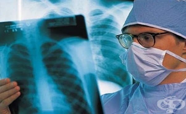 В Шуменска област започват прегледи за туберкулоза сред рискови групи - изображение