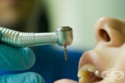 Българският зъболекарски съюз предлага да бъде извършено безплатно зъбно протезиране на пенсионерите - изображение