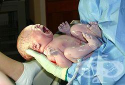 Клинична патология на новороденото дете - изображение