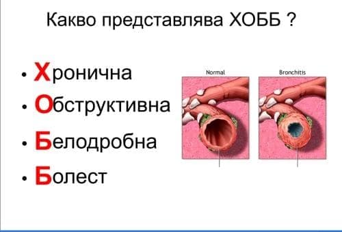 Хроничната обструктивна белодробна болест - ХОББ - презентация на доцент Димитър Попов - изображение
