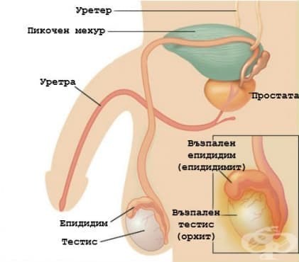 Усложнения при мъже