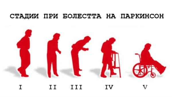 Стадии при болестта на Паркинсон