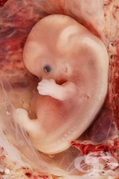 Ембрион в 9-та г. с.