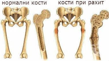 Форма на костите