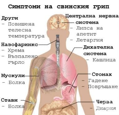 Симптоми на свинския грип