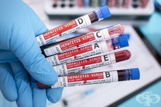 Увреден черен дроб следствие от хепатит